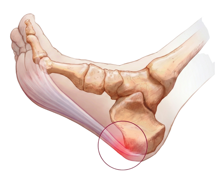 Y así es como empieza